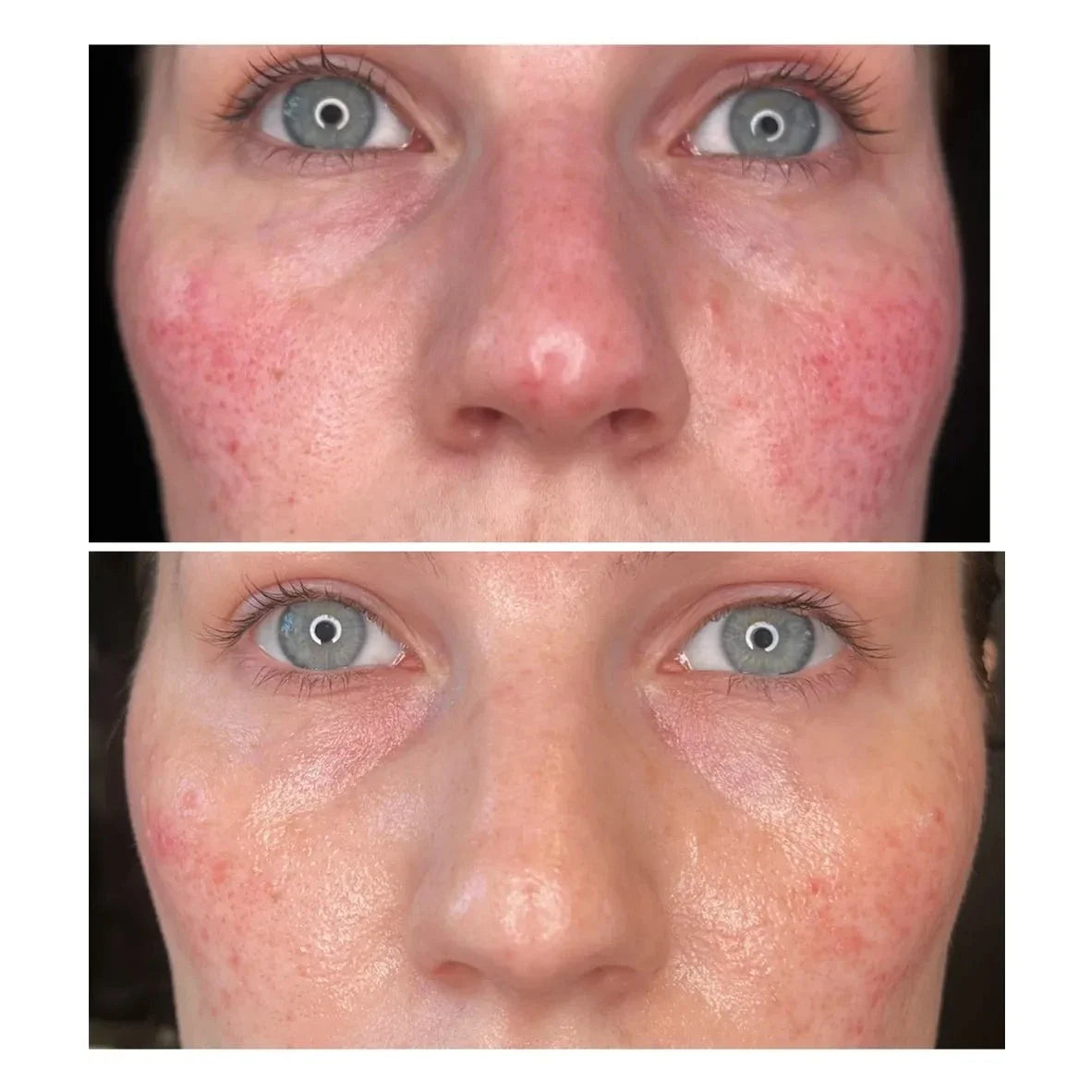 BioRe Peel Peel Party Deposit