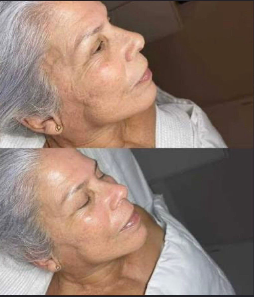 Peptide Perfection Peel Party