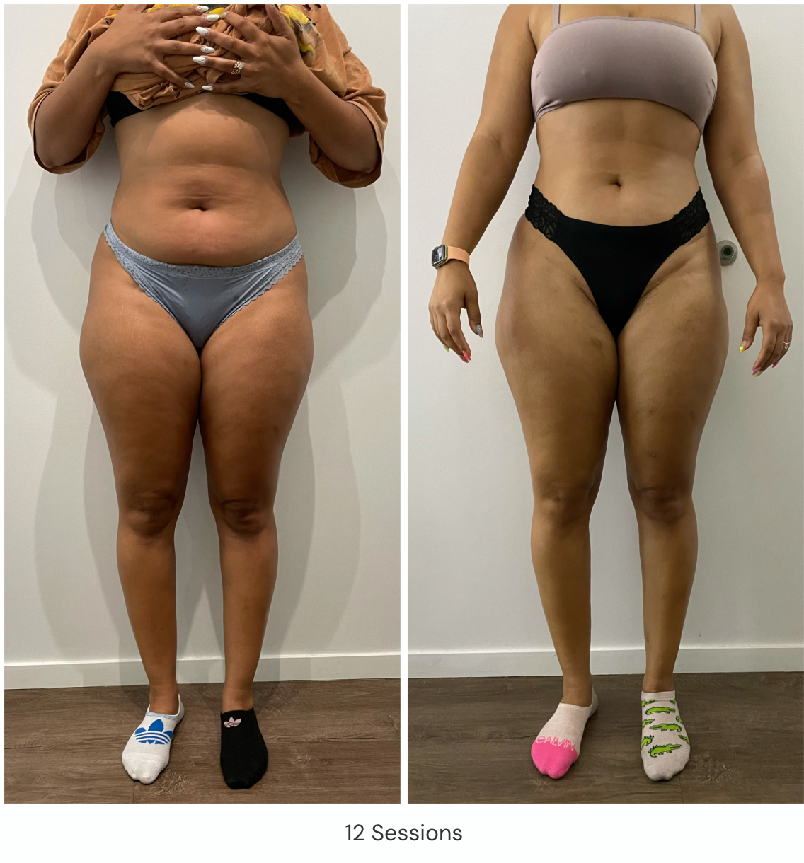 Emerald + Cell Therapy Single Sessions