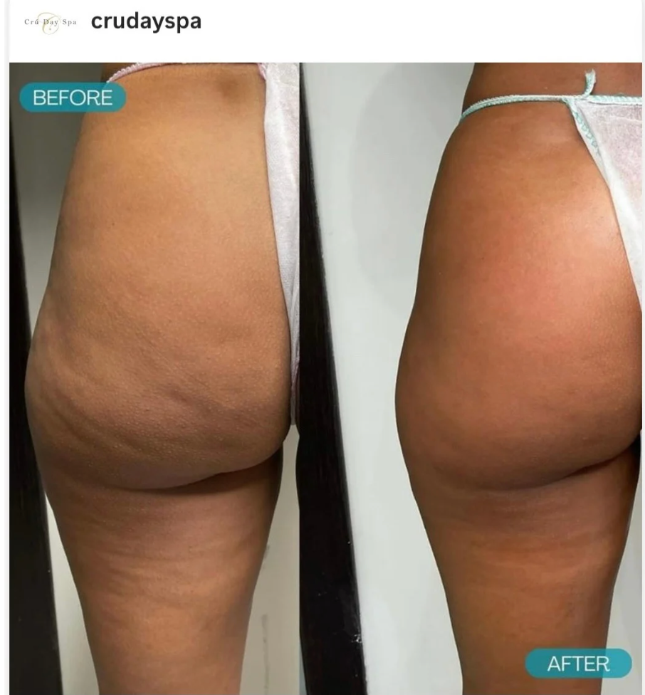 Cell Therapy 3 Series