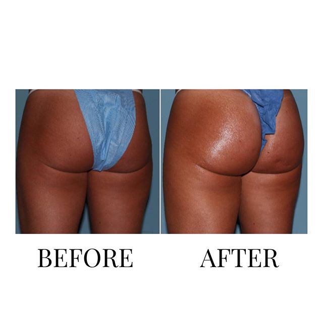 Cell Therapy 6 Series