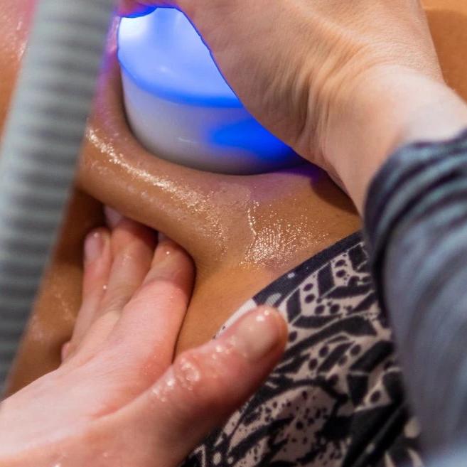 Cryoskin Slimming
