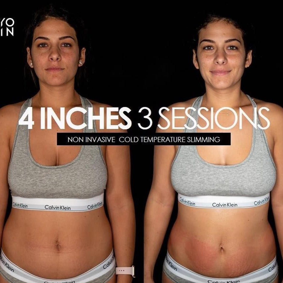 Cryoskin 8 Slimming Series