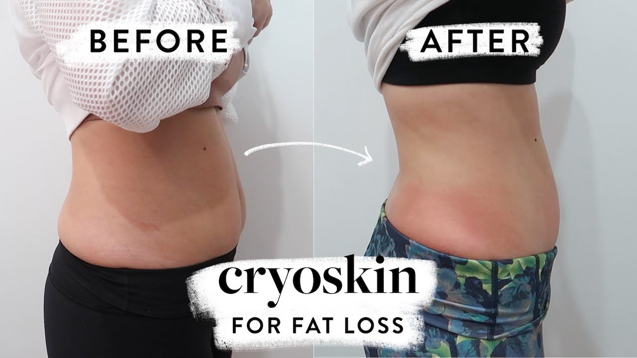 Cryoskin Slimming 5 Series + Cell Therapy 3 Series