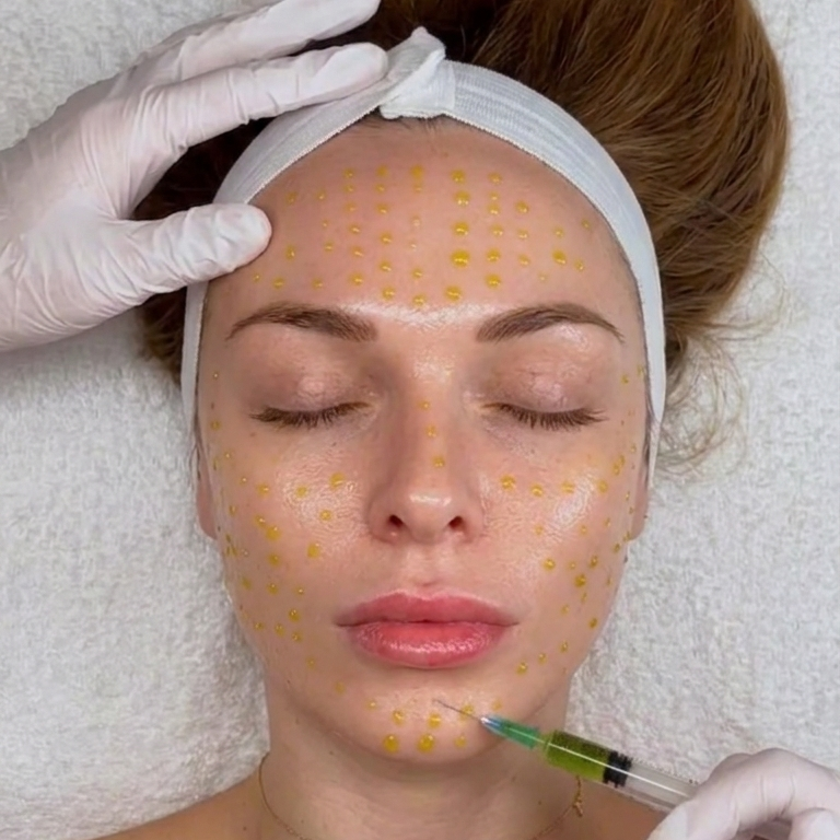 Age Reverse Anti-Oxidant Peel 3 Series