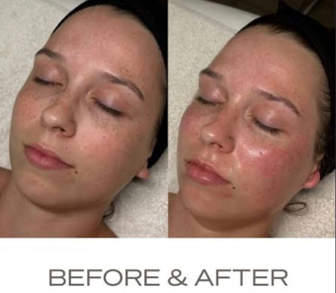 Peptide Perfection Peel Party