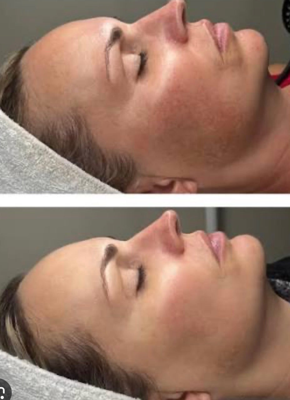 Peptide Perfection Peel Party