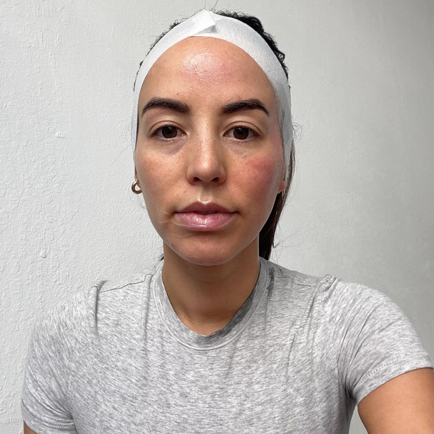 2 Cryoskin Facials + Cryoskin Slimming Treatment