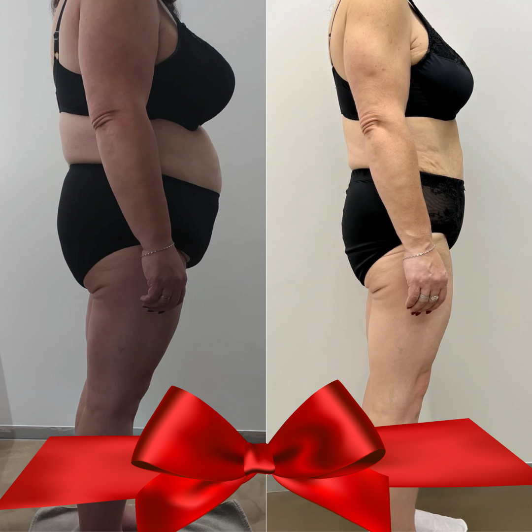 Emerald Laser 12 Series Get 5 Free