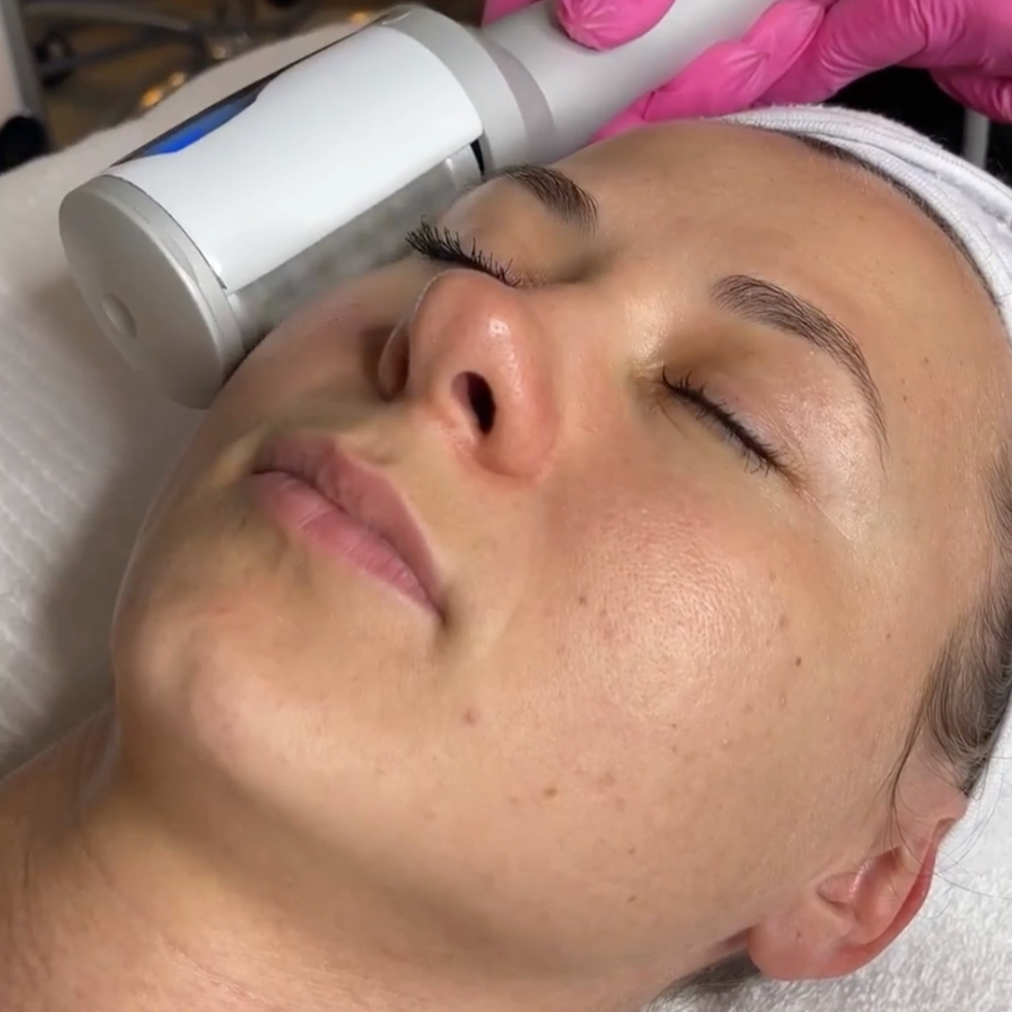 Cell Therapy Facial